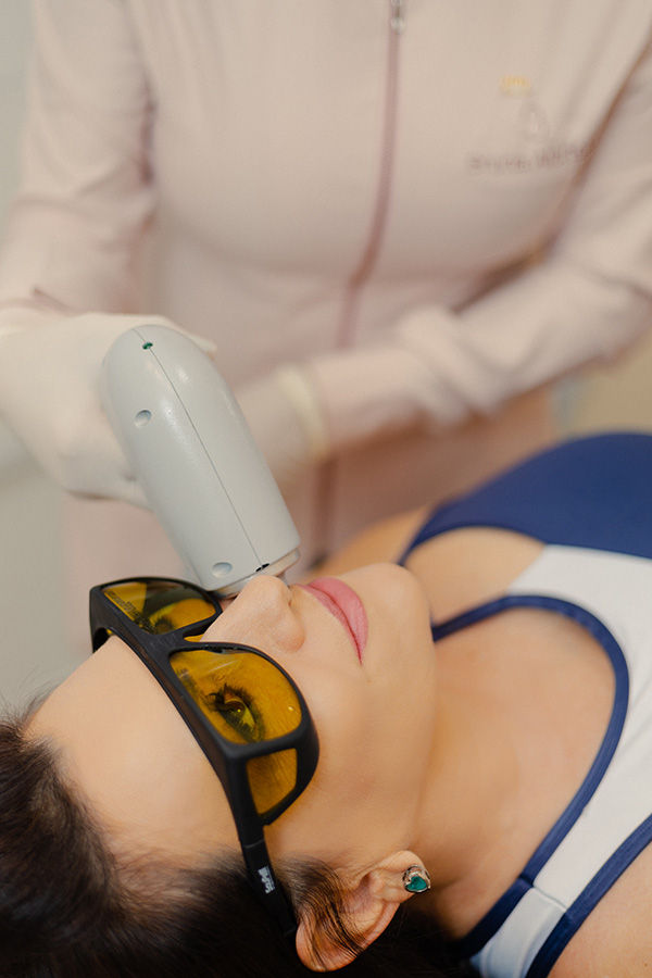 Exemplo de procedimento de depilação a laser em mulheres 2
