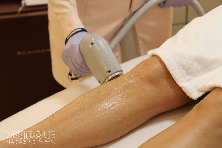 Exemplo de procedimento de depilação a laser em mulheres 3
